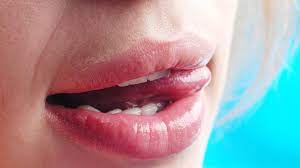 Die meisten unebenheiten, beulen oder pickel auf der zunge sind nicht ernst. Blaschen Auf Der Zunge