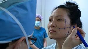 By far the most common surgery that koreans do, according to dr. What Is Korean Plastic Surgery Korean Fashion Trends