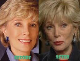 Lesley young age and current photo