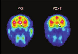 Image result for Modafinil