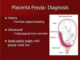 If a woman is bleeding during the first trimester of pregnancy, the possibility of a miscarriage must be ruled out. Womens Health Third Trimester Bleeding Youtube