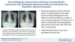 Recognizing normal anatomy on the cxr is key to understanding and interpreting abnormalities. Chest Radiograph Interpretation With Deep Learning Models Assessment With Radiologist Adjudicated Reference Standards And Population Adjusted Evaluation Radiology