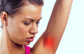 D.roberts published by april 10, 2017 modified by september 20 the pectoralis muscle is a major muscle discovered on your chest. Underarm Pain Symptoms Causes Treatments