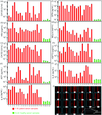 Symptoms of ovarian cancer are vague, and women with the disease are often not diagnosed until the cancer has spread to other parts of the body. A High Performance Microfluidic Detection Platform To Conduct A Novel Multiple Biomarker Panel For Ovarian Cancer Screening Rsc Advances Rsc Publishing Doi 10 1039 D0ra10200h