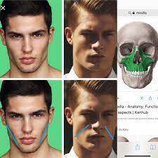 The technique itself is simple: I Think The Reason Why Some People Have Hollow Cheeks On The Right And Some On The Left Is Difference In Growth Of Maxila U Can See On The Right Maxila Is Taking