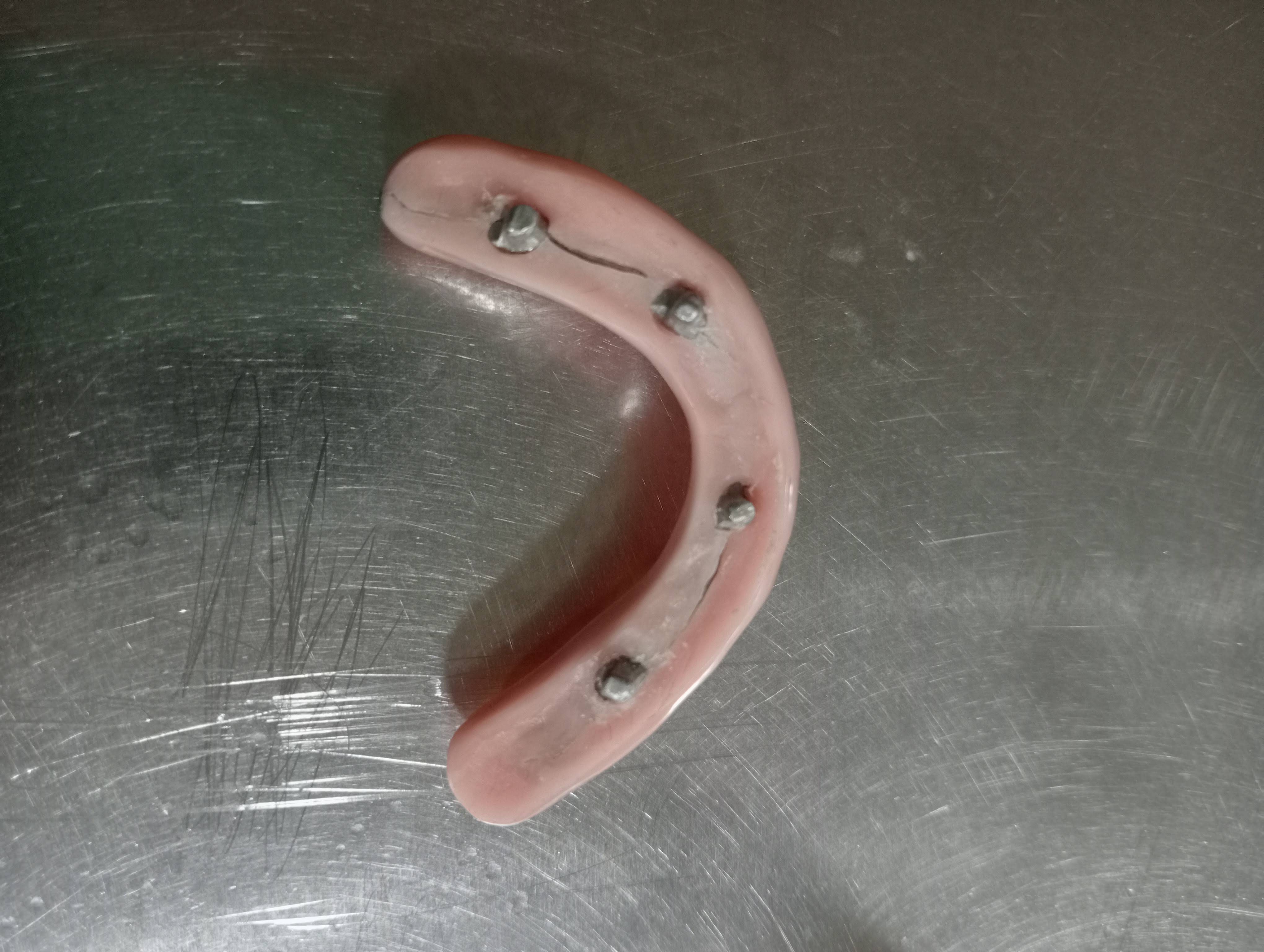 Dental implants