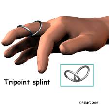 Diy ring splints for ehlers danlos. Physical Therapy In Jackson For Swan Neck Deformity Of The Finger