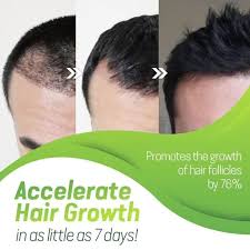 Grow your hair fast this hair growth tips is much more effective. 7x Rapid Hair Growth Serum Make Your Life Easier
