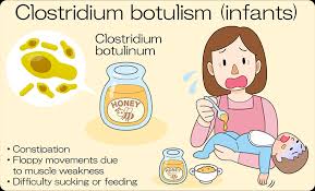 Image result for Botulism