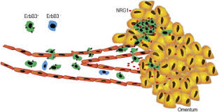 Hematogenous Metastasis Of Ovarian Cancer Rethinking Mode Of Spread Sciencedirect