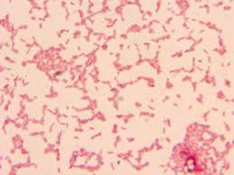 They are characterized by their cell envelopes, which are composed of a thin peptidoglycan cell wall sandwiched between an inner cytoplasmic cell membrane and a bacterial outer membrane. Pin On Microcosmos