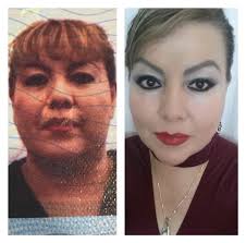 Maria Lasher skinrevolution.neora.com