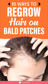 10 Home Remedies To Regrow Hair On Bald Patches Video Video In 2020 Regrow Hair Hair Care Secrets Hair Maintenance