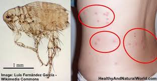 Pin On Home Remedies