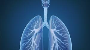 Bronchiectasis - Bronchiectasis