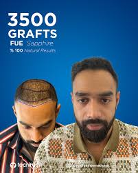 Tecnifue International