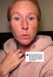 Tesmorlin Peptide Dosage