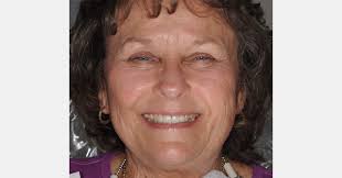 Enamel Rods: The Key to Successful Restorative Adhesion