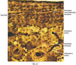 Important features in the bone cross section such as harvesian canals, osteons, osteon fragments, lamellar bone, bony trabeculae, myxoid matrix and artifact for. Anatomy Atlases Atlas Of Microscopic Anatomy Section 1 Cells