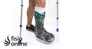 Fracturas De Maleolo Fisioonline
