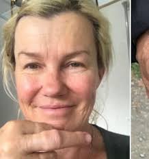 Kiwi actress Robyn Malcolm injures hand protecting pet dog Tara