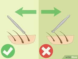 Plucking nose hairs can lead to infections or ingrown hairs. 3 Ways To Avoid Bumps When Plucking Hair Wikihow