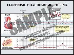 Image result for Late Deceleration