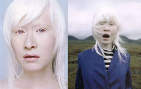What is your favorite colour hair and eye colour conbination on a guy. Poll Rarest Hair Eye Color Combo Yahoo Answers Albino Model Albino Girl Albinism