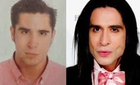 #bichectomia cambia el contorno de tu cara al disminuir tejido graso de tus mejillas aparta tu cita de valoración. Bolas De Bichat 10 Verdades Mitos Y Mentiras Clinicas Diego De Leon