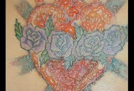 Tattoo Allergic Reaction Picture Image On Medicinenet Com