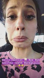 The loose women star, 31, suffered with ag… Pregnant Stacey Solomon Shares Trip To Dentist Entertainment Daily