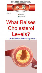 Cholesterollevels How To Lower Triglycerides And Raise Good Cholesterol How To Get Your Cho What Causes High Cholesterol Cholesterol Diet Cholesterol Levels