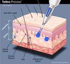 What Causes Pimples How Skin Works Tattoo Process Tattoo Process Good First Tattoos First Tattoo