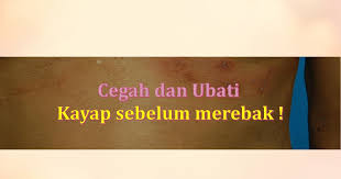 Penyebab sering kaget saat tidur dan jantung berdebar cepat. Cara Ubati Kayap Secara Traditional Atau Suplemen Sebelum Kronik
