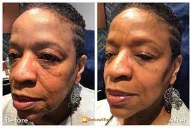 Is there a jack and jill spa in nashville? Jack And Jill Aesthetics Gift Card Franklin Tn Giftly