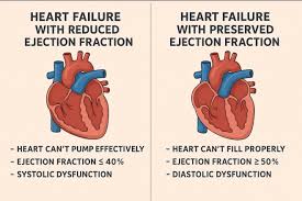 Image result for Systolic Dysfunction