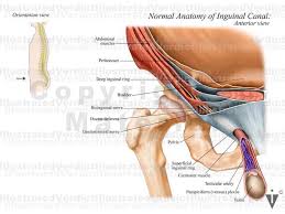 Image result for Inguinal hernia man