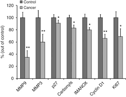 A pleural effusion occurs when excess fluid collects between the membranes that line the lungs and chest wall. Pleural Fluid Analysis Of Lung Cancer Vs Benign Inflammatory Disease Patients British Journal Of Cancer