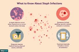 Mar 31, 2021 · most mrsa infections are skin and soft tissue infections that produce the following signs and symptoms: Staph Infection Overview And More