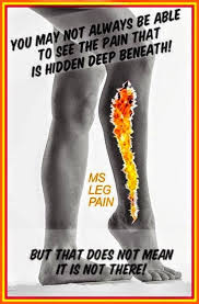Welcome To Suddenly Multiple Sclerosis Multiple Sclerosis Multiple Sclerosis Awareness Fibromyalgia