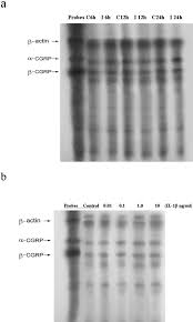 Ils étaient stationnés dans un camp militaire, situé dans le centre du pays, à 85 kilomètres de la frontière avec la mauritanie. Mechanism Of Interleukin 1b Induced Calcitonin Gene Related Peptide Production From Dorsal Root Ganglion Neurons Of Neonatal Rats Hou 2003 Journal Of Neuroscience Research Wiley Online Library