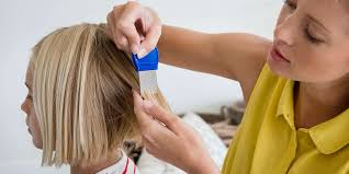 Let your hair dry with the vinegar in them. How To Treat Head Lice Effectively With Combs And Medication