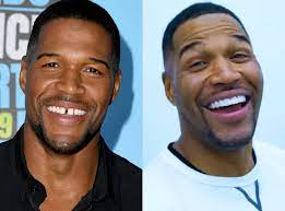 This site is using cookies under cookie policy. Michael Strahan Closes Signature Tooth Gap In Must See Transformation E Online Deutschland