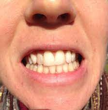 Maybe you would like to learn more about one of these? Heal A Dead Tooth With Essential Oils Modern Hippie