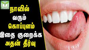 Since demineralizing or lack of minerals are a cause of tooth decay, using fluoride mouthwash can be a great home remedy to get rid of cavities as well as tooth decay. How To Get Rid Of Tooth Cavity At Home Teeth Care Tips In Tamil Tamil Health Beauty Tips Youtube