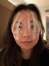 我和先生在台全眼科診所的整體體驗非常棒，真的忍不住想要推薦給每一位正在考慮視力矯正手術的朋友！  從第一次諮詢開始，診所的專業程度就讓我們印象深刻。工作人員非常細心，耐心地向我們解釋了各種視力矯正手術的選項，包括LASIK、PRK 和SMILE  PRO。我們對這些技術的 ...