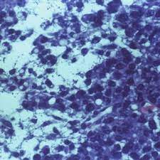 It usually begins to form in the cells in the glands, which are found in the lungs. Pdf Mesothelioma In Domestic Animals Cytological And Anatomopathological Aspects