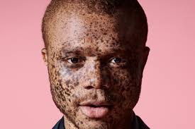 River Island's fashion campaign featuring models with disabilities and more  is getting a lot of love