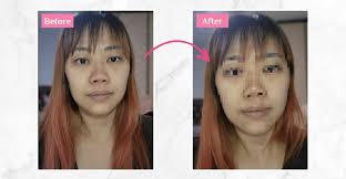 Browhaus Plasma Lift review: 24 reviewers share results after a few  sessions and how the Wide Focus eye cream helped