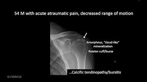Image result for Shoulder Imaging